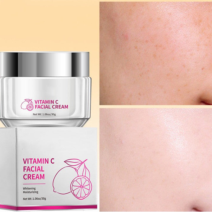 Vitamin C Face Cream for Brightening & Anti-Aging – Dark Spot Remover Moisturizer