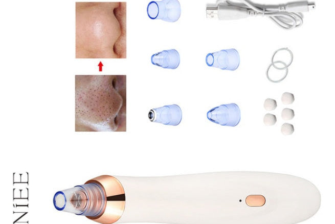 Electric Facial Pore Cleaner – Blackhead Remover for Clear, Glowing Skin