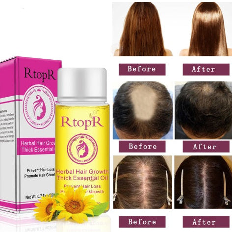 Hair Growth Booster Oil – Anti Hair Loss Serum for Longer, Thicker Hair