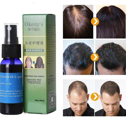 Anti Hair Loss Spray – Hair Growth Treatment for Thinning Hair & Bald Spots