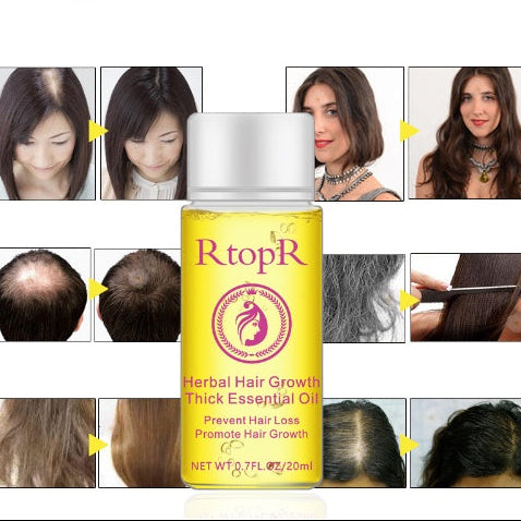 Hair Growth Booster Oil – Anti Hair Loss Serum for Longer, Thicker Hair