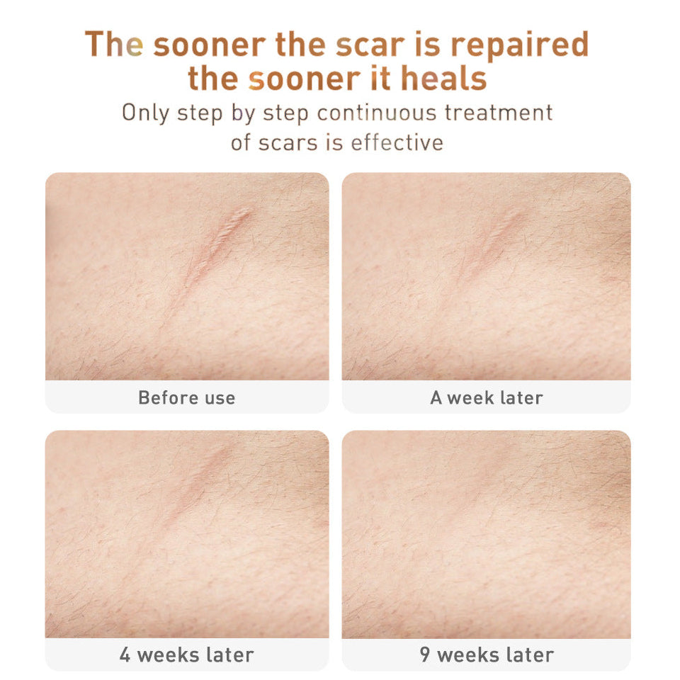 Dark Spot & Scar Remover Cream – Brightening Skin Repair Treatment