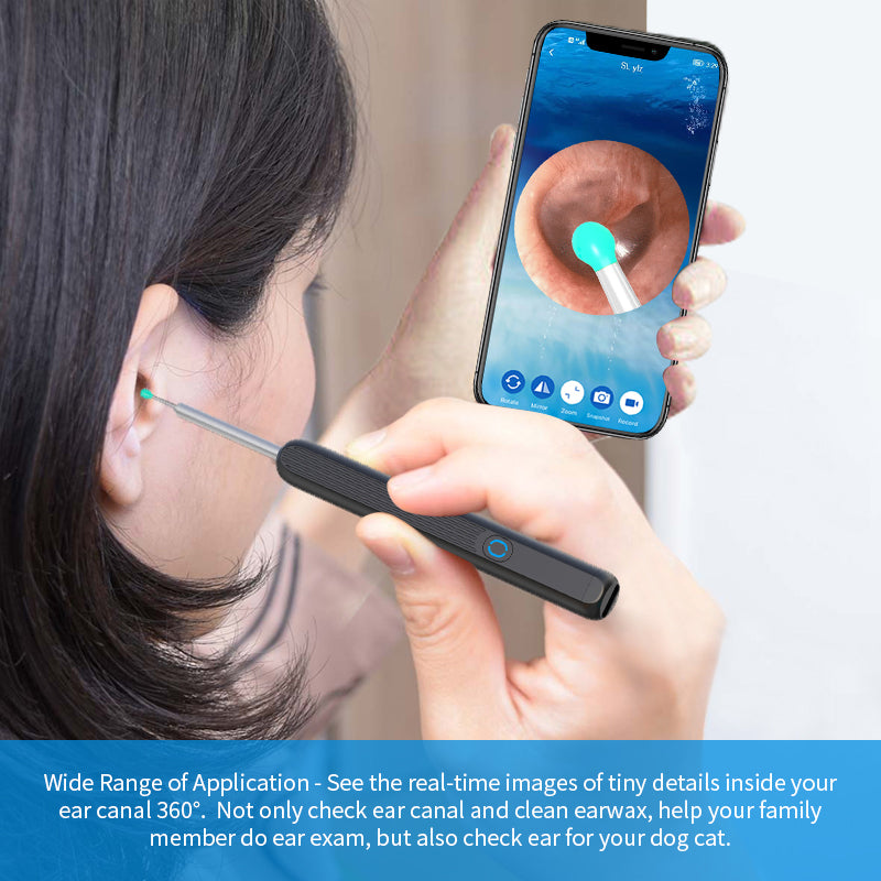 Smart Ear Cleaner with Camera – Wireless Ear Wax Removal Tool