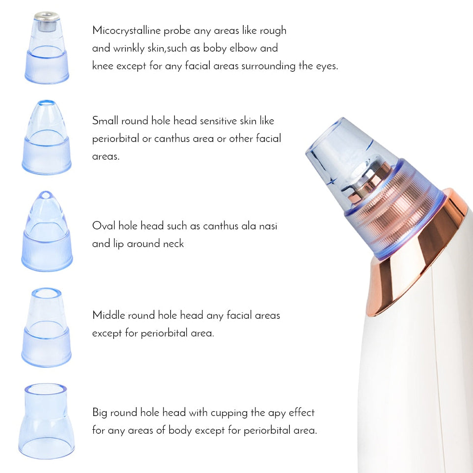Electric Facial Pore Cleaner – Blackhead Remover for Clear, Glowing Skin