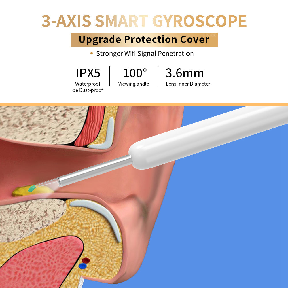 Smart Ear Cleaner with Camera – Wireless Ear Wax Removal Tool