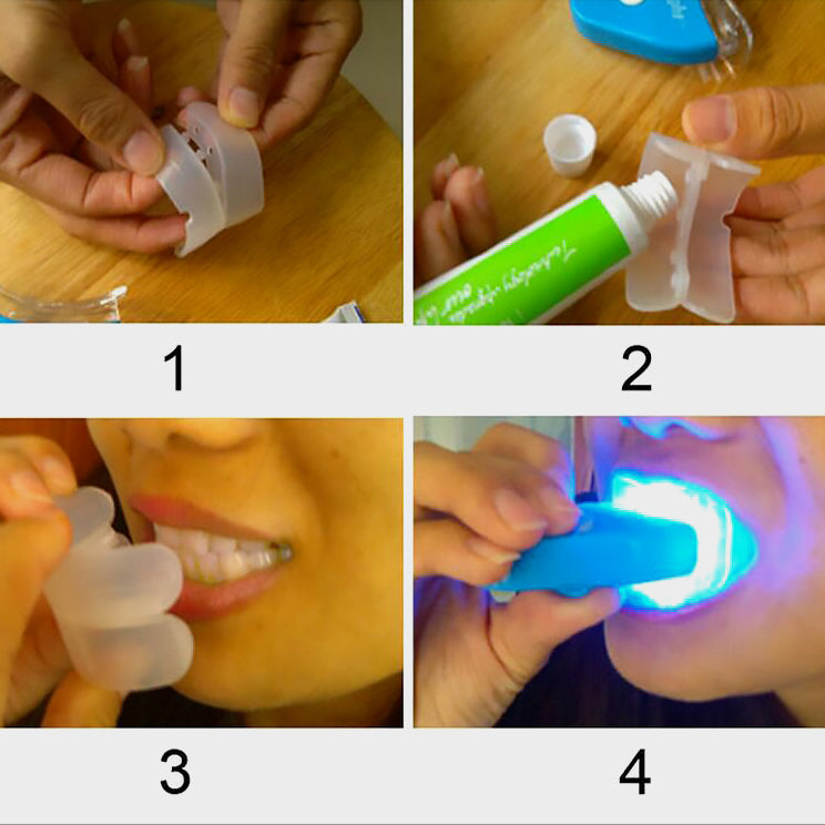 Teeth Whitening Kit with LED Light – Remove Stains & Brighten Smile Fast