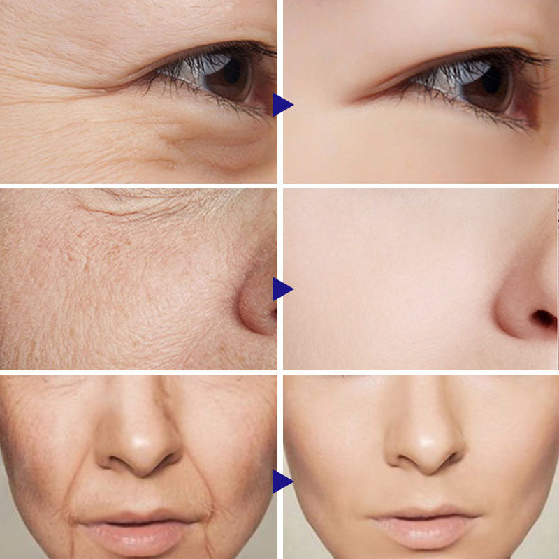 Vitamin C Face Serum | Dark Spot Corrector & Skin Brightening Anti-Aging Serum