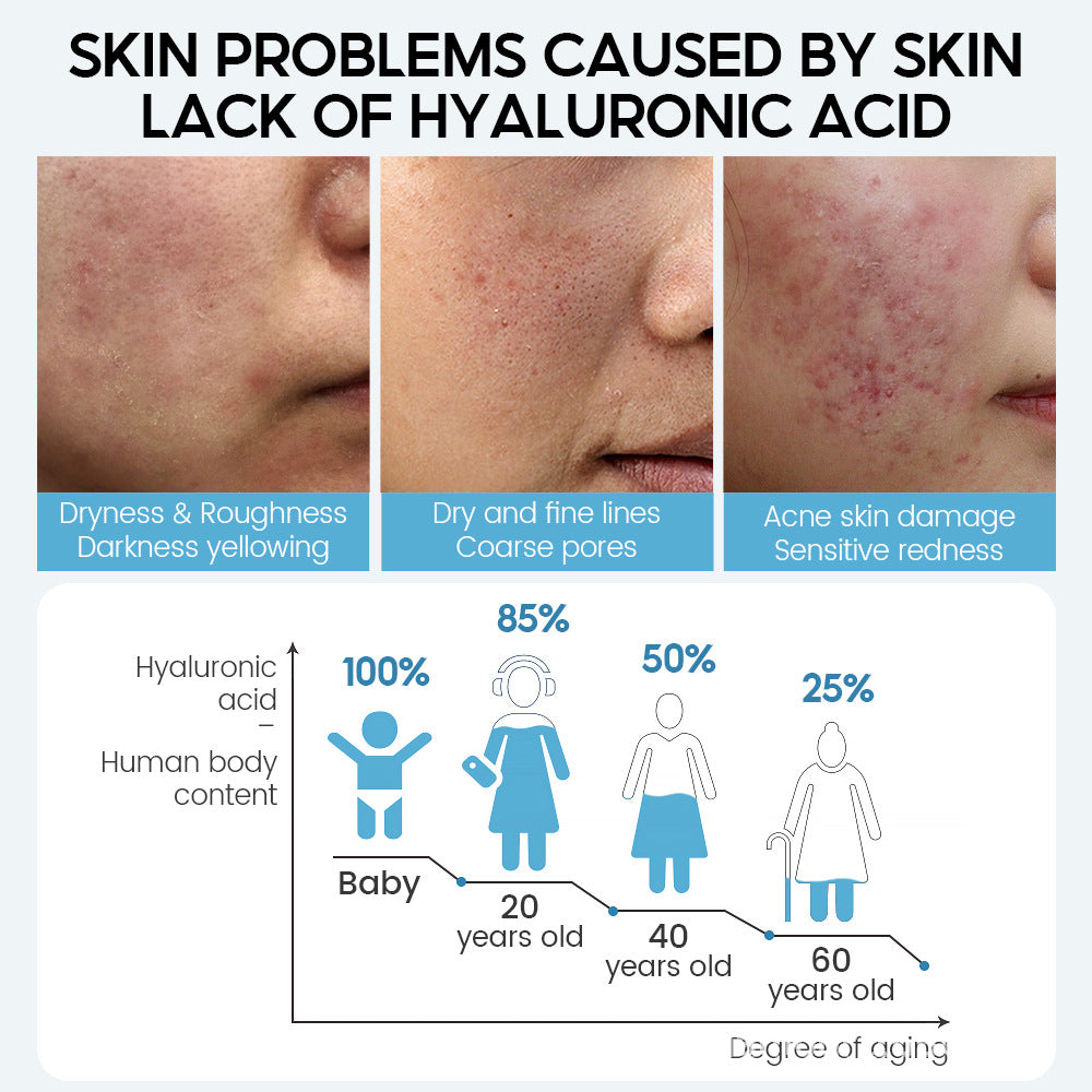 Hyaluronic Acid Face Serum – Deep Moisture, Pore Minimizing & Youthful Glow Boost