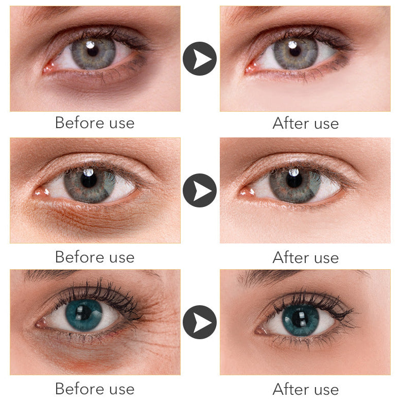 Anti-Aging Under Eye Cream – Collagen Boost, Dark Circle Corrector & Hydrating Formula