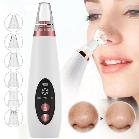 Blackhead Remover Machine – Deep Pore Vacuum Cleaner for Acne-Free Skin