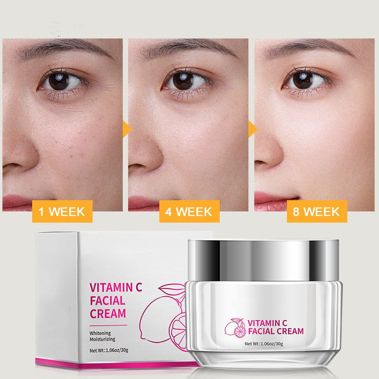 Vitamin C Face Cream for Brightening & Anti-Aging – Dark Spot Remover Moisturizer