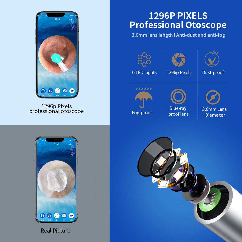 Smart Ear Cleaner with Camera – Wireless Ear Wax Removal Tool